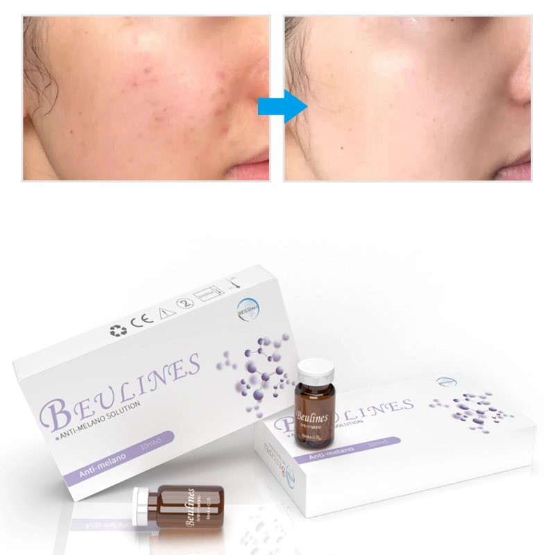 Hyperpigmentation Hydroquinone Vitamin C Serum Mesotherapy Dark Spot Remove Spot Removal Serum