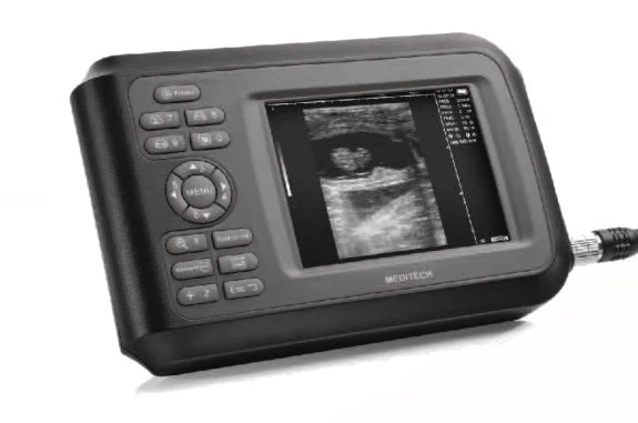 Portable Plam Ultrasound Scanner with CE Certificate Family Doctor Clinical