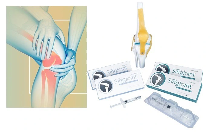 Иными словами Singjoint шприц инъекции гиалуроновой кислоты для Osteoarthritis гель для взрослых