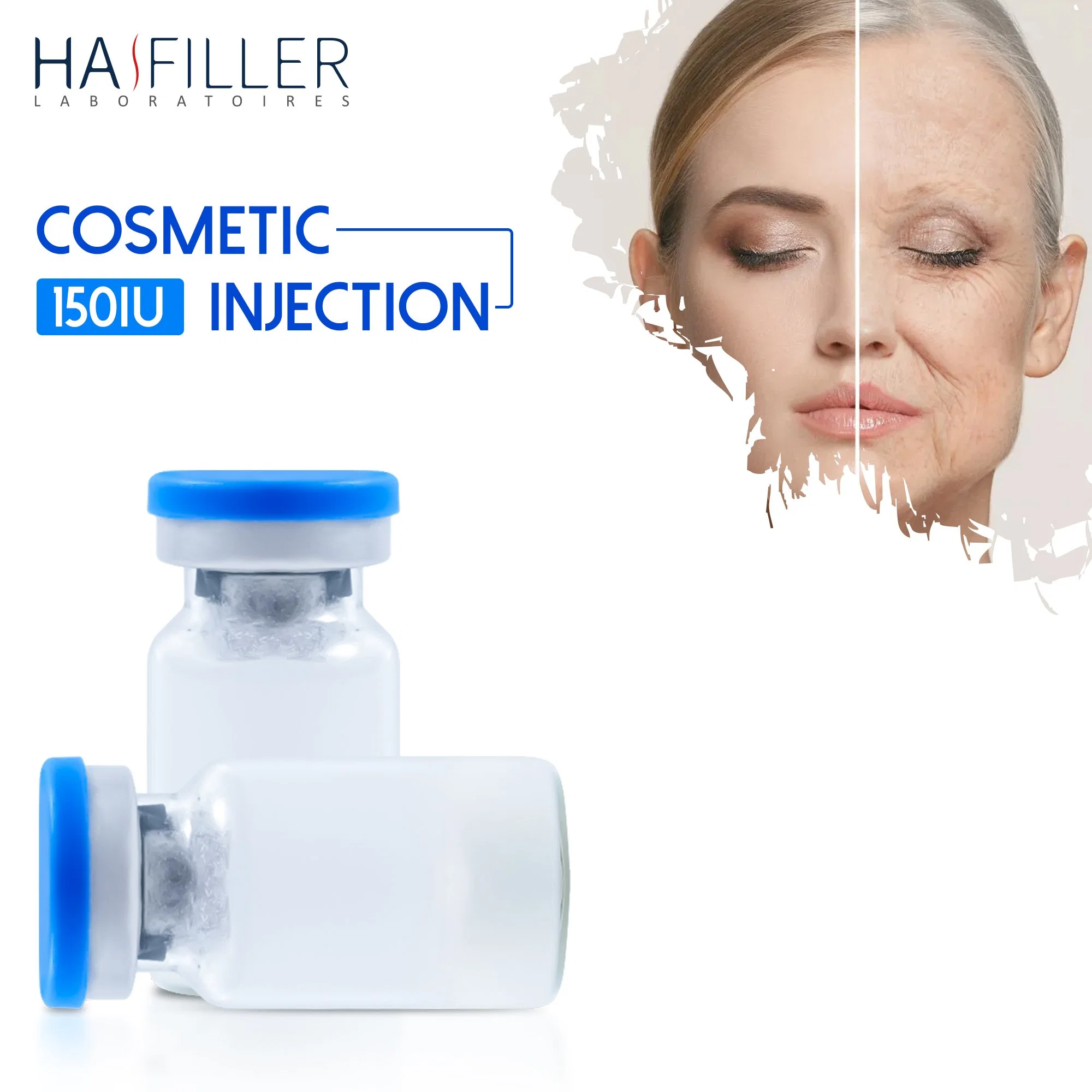 Vente à chaud Nabta 150iu produit face Lift anti poudre de wrinkle Injection de linum butu BT X.