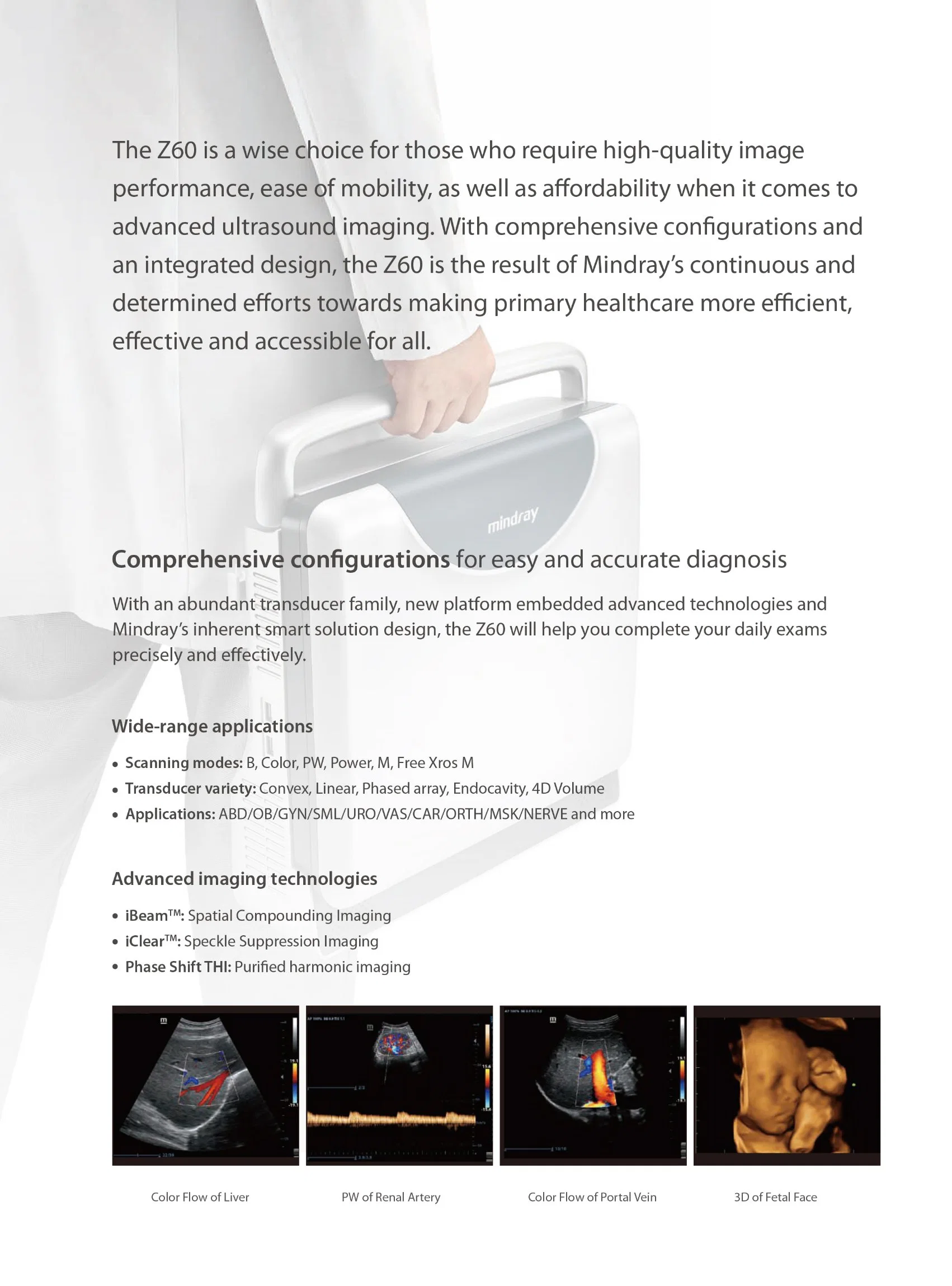 Mindray Z60 Color Doppler Ultrasound Machine