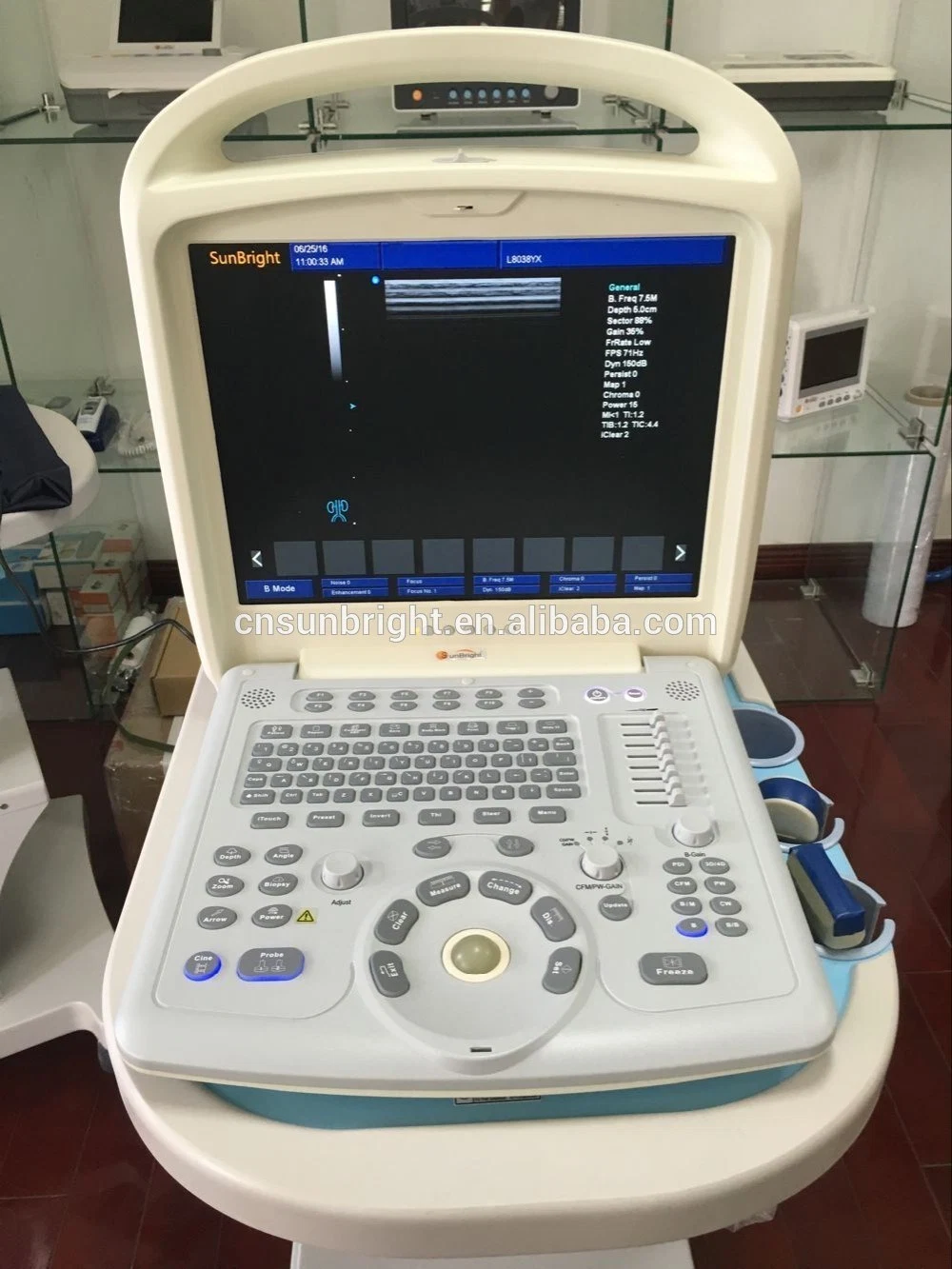 China Portable Color Doppler 2D 15 Inches Display Sonography Machine Portable Ultrasound