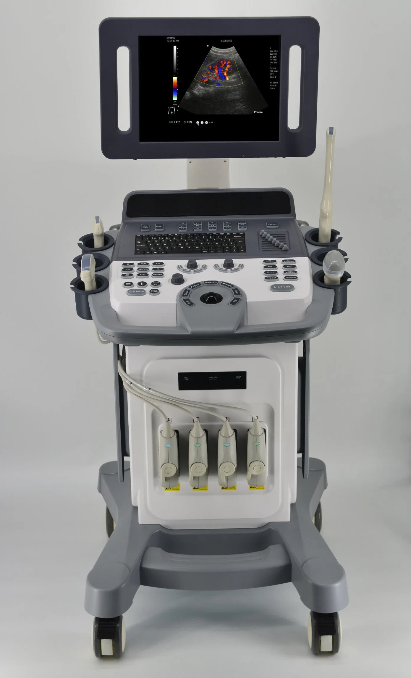 Trolley Color Doppler Ultrasound Scannercansonic K10