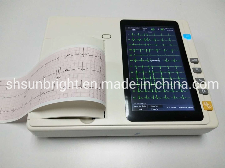 Hospital 3 Channel Color Screen ECG Machine Price