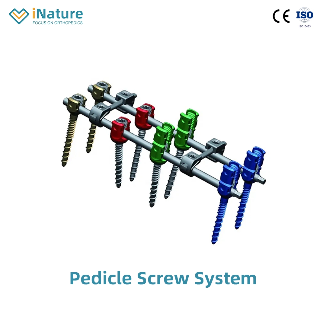 Orthopedic Spinal Implant Posterior Inter-Fixation System Titanium Medical Products Supply Pedicle Screw