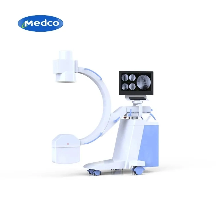 Medical Equipment Digital Mobile X Ray C Arm System