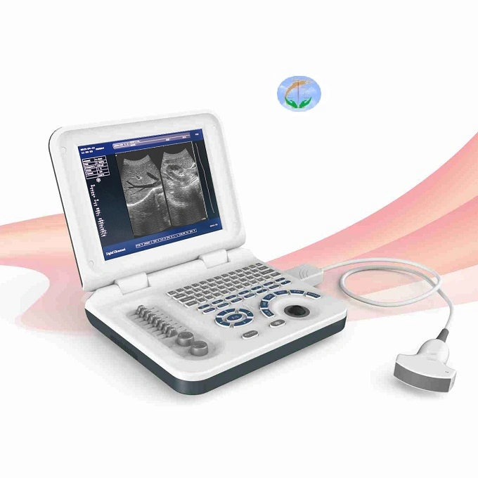 China Supply 10.4 Inch Screen Medical Ultrasound Machine Portable Ultrasound Scanner