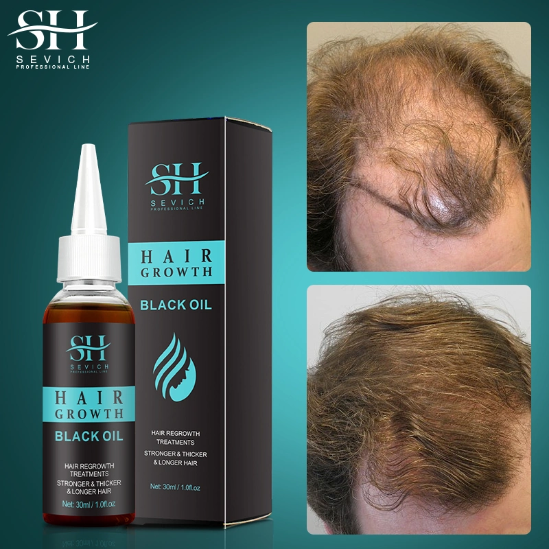 Hair Growth Black Serum Hair Growth Oil Loss Treatement