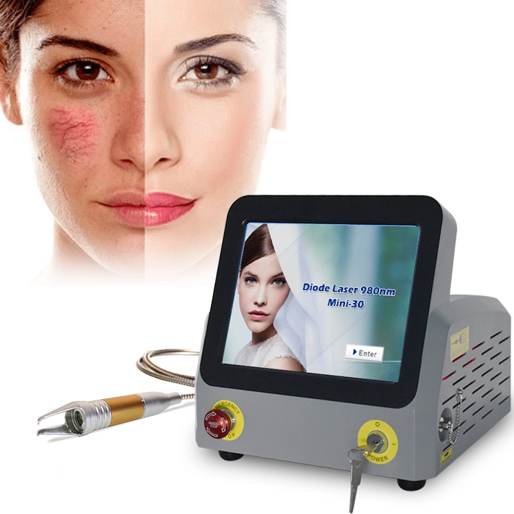 Медицинский лазер 60 Вт 980мм Spider Veins Vascular Machine Portable Non-Invasive Устройство для удаления сосудов Spider Vein