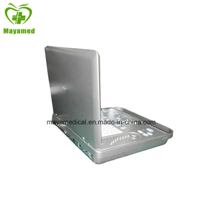 My-A009 15inch Screen PC Based Laptop Ultrasound B Scanner