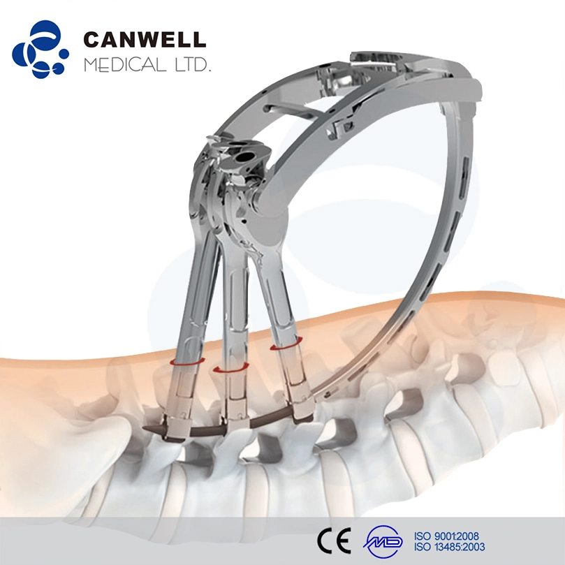 Canwell implantes de columna mínimamente invasiva, Thoracolumbar tornillos pediculares