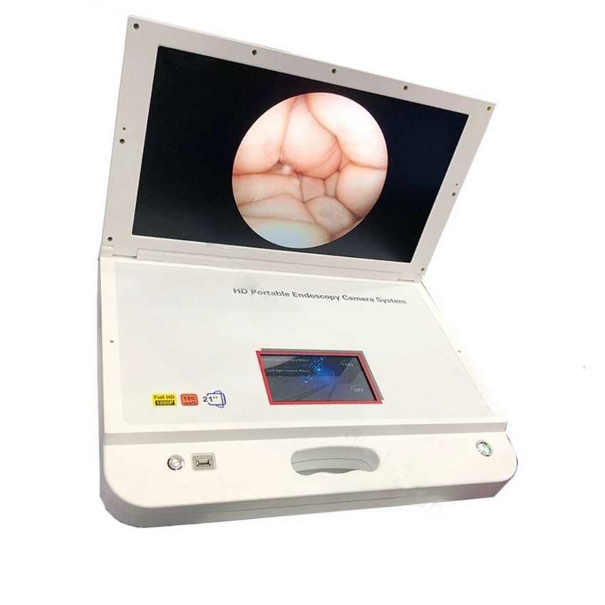 Laparoscope/Ent/Urology/Arthroscopy Surgical Endoscopy Camera, Full HD 1080P Endoscopic Camera System with LED Light Source & Medical Endoscope Monitor Price