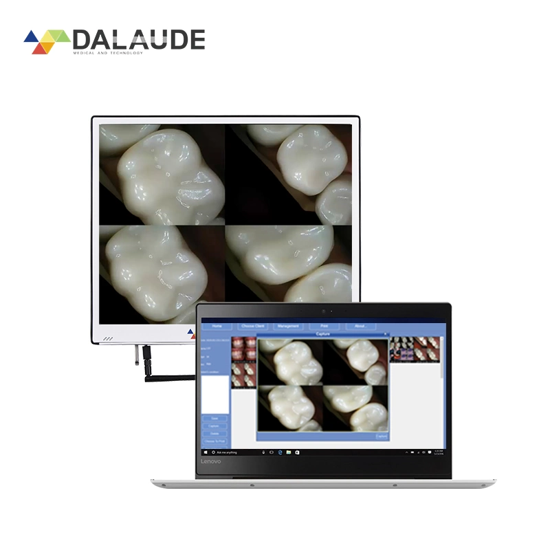 Metallgehäuse Ultrain Monitor mit HD Intraorale Kamera, Dental Equipment