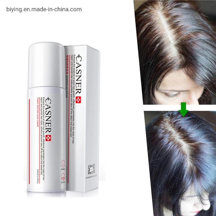 Private Label Hair Care Regrowth Hair Loss Treatment Bald Hair Regrowth Effective Hair Growth Spray