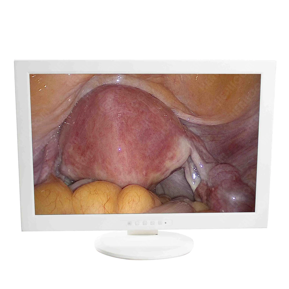 Medical Imaging System Carrinho Endoscopia Digestiva cirurgia otorrinolaringológica vídeogravador Conjunto Completo de preço