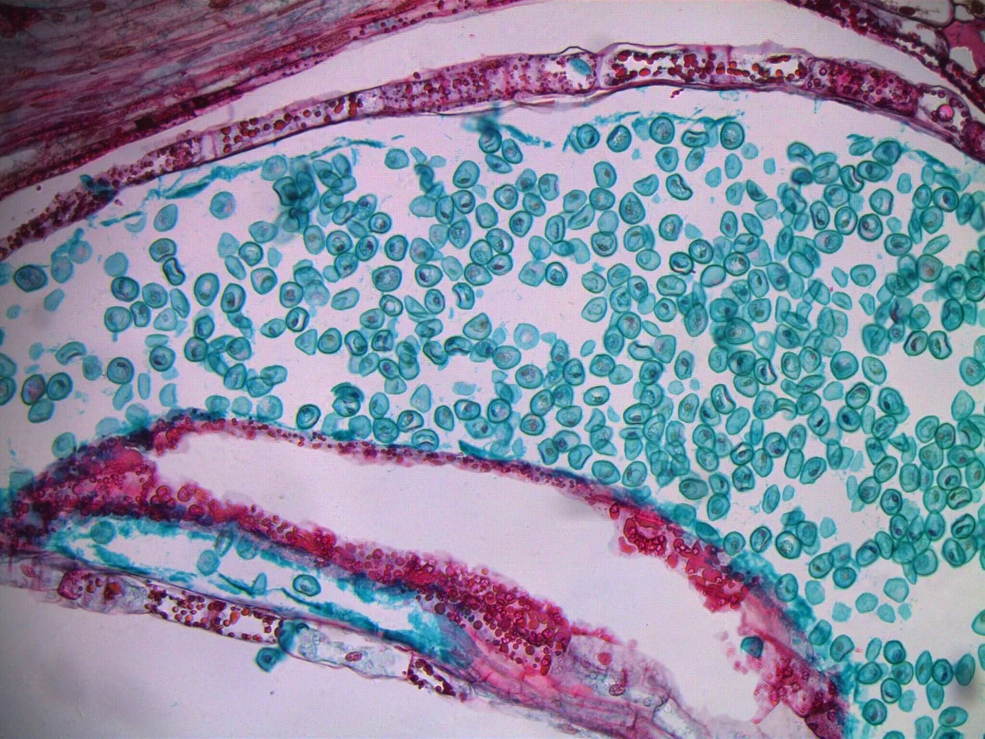 Bestscope BS-2044b microscopio biológico con plan de campo amplio de punto de vista alto Ocular