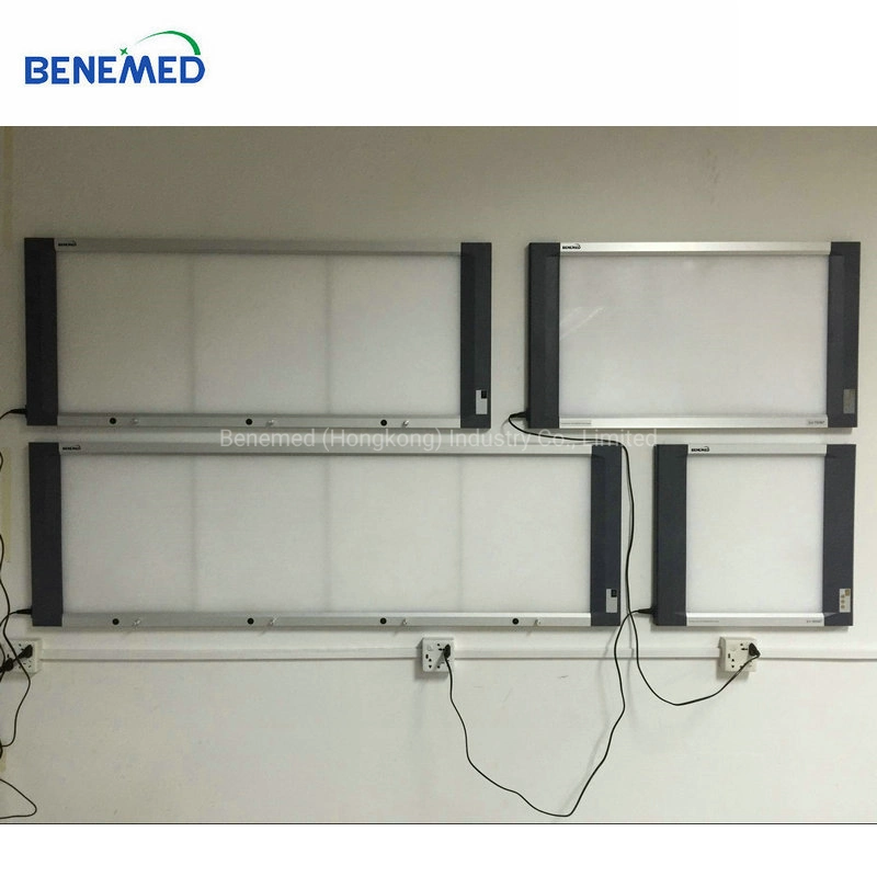 Uso hospitalario LED X-ray el visor de la película cuatro sección