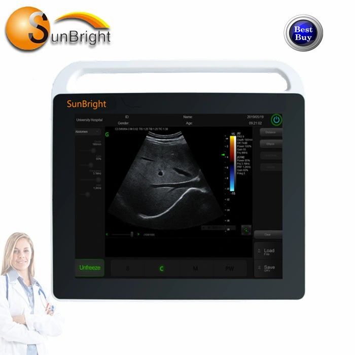 Sunbright Doppler Ultrasound Scanner Touch Screen 15 Inch LED Ultrasonic Portable Equipment Sun-800s