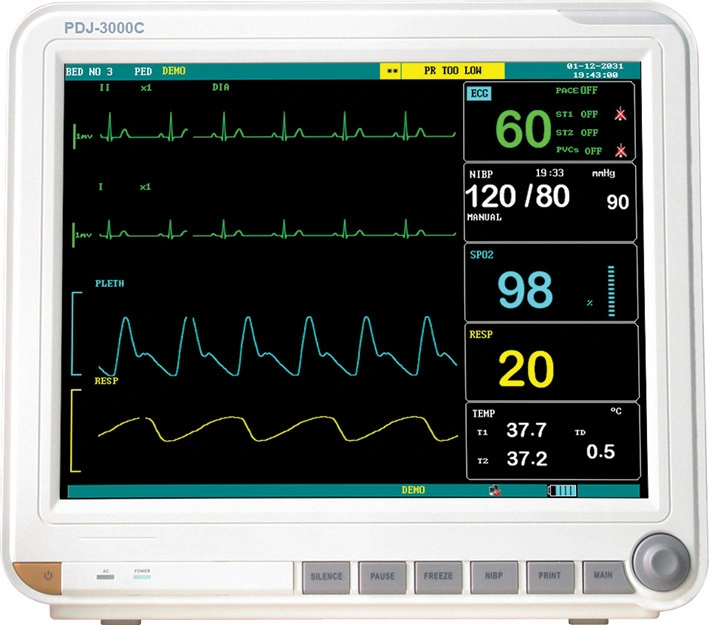 Cheap Handheld Patient Monitoring System/Patient Monitor