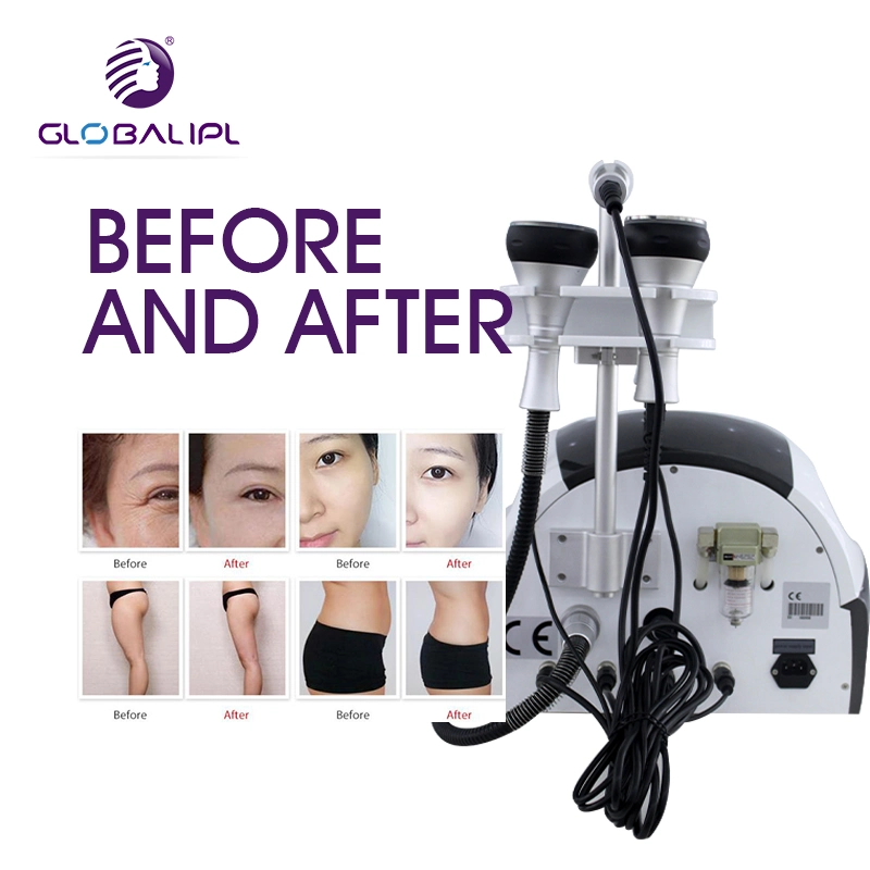 Cavitation + RF Body Slimming Machine Portable Ultrasound Slimming with 3 in 1 Device