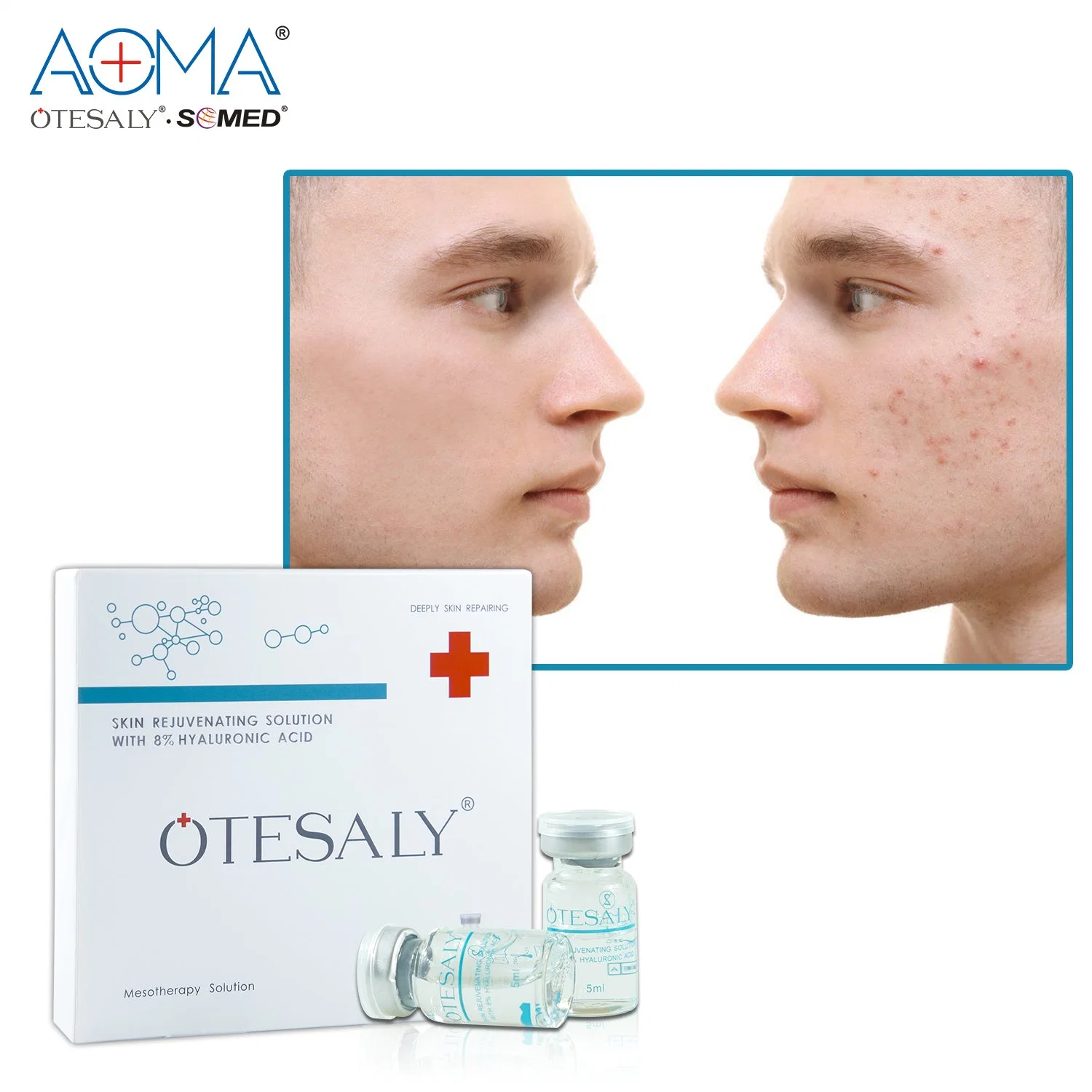 Otesaly Wholesale Price Skin Rejuvernation with 8% Ha Fine Lines Skin Dry Mesotherapy Solution Via Meso Gun