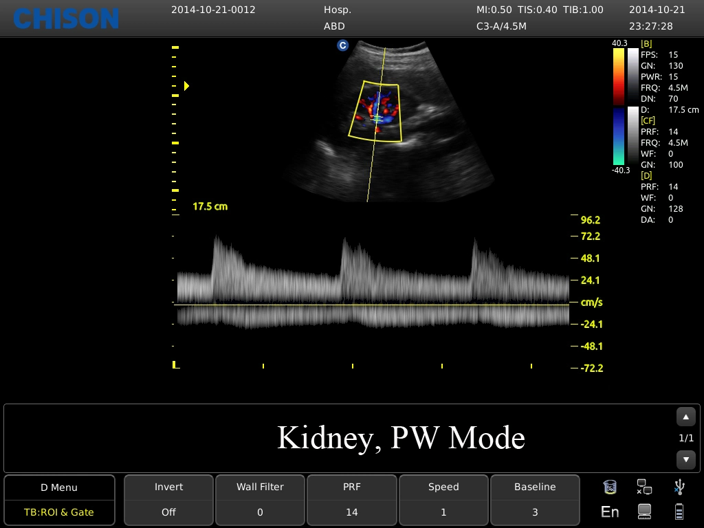 Chiosn EBIT 60 Ecografo Portable Color Doppler System für Geburtshilfe/Gynäkologie, Urologie, Kardio, Rektum, Kinder, Orthopädische Ebit50 Ebit60