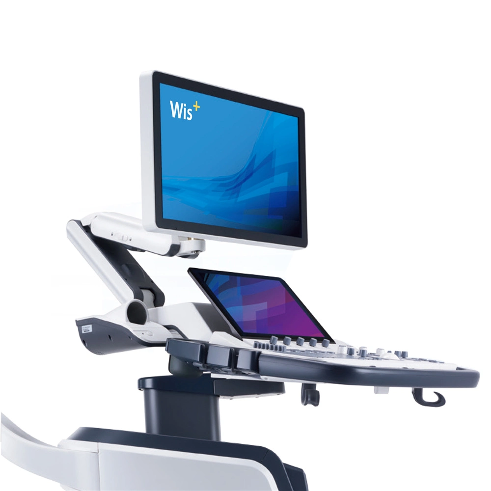 Sonoscape S60 13.3 Inch Quick Responsive Touch Screen Color Doppler Trolley Ultrasound Machine