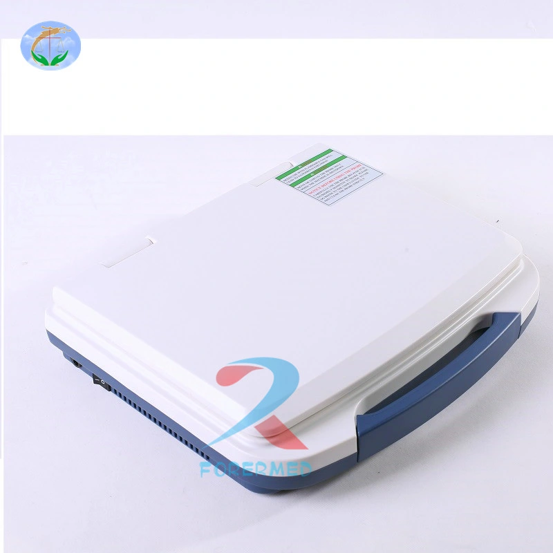 China Manufacturer Diagnostic Imaging Portable Sonar Ultrasound Scanner