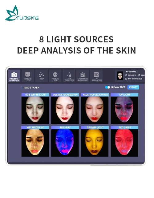 Popular Skin Care Digital Deep Facial Skin Moisture Analysis Scanner Medical Equipment