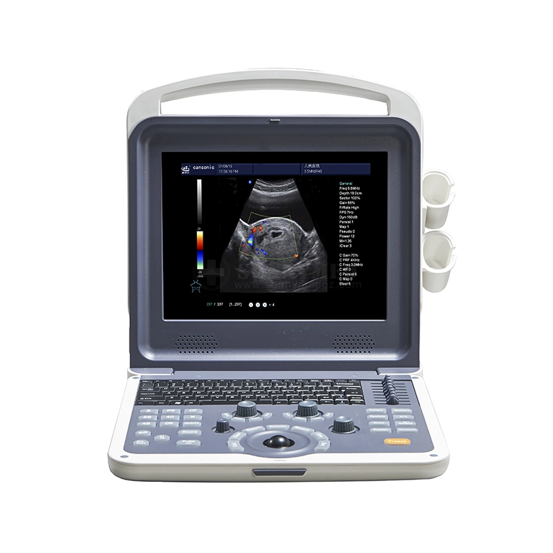 Sy-A042n Cheap Color Doppler Handy Baby Scanner Medical Digital Ultrasonography Ultrasound Machine Price