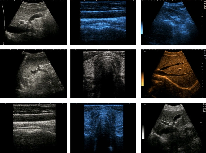 B/W Ob Gyn Urology Vascular Msk Ultrasound Scanner Digital Laptop Ultrasonic Equipment to Human