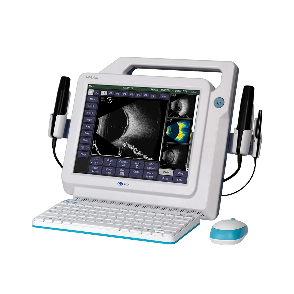 Veterinary Portable B Scan Ultrasound a/B Scanner for Animal Use for Ophthalmology (MD-2300S)