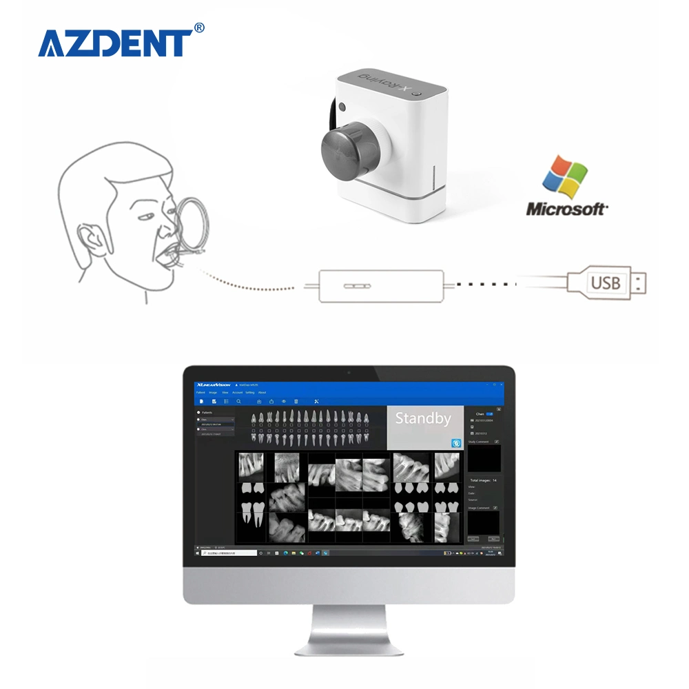 Nuevo detector de la tecnología Digital Dental Rvg Sensor de rayos X Intraoral