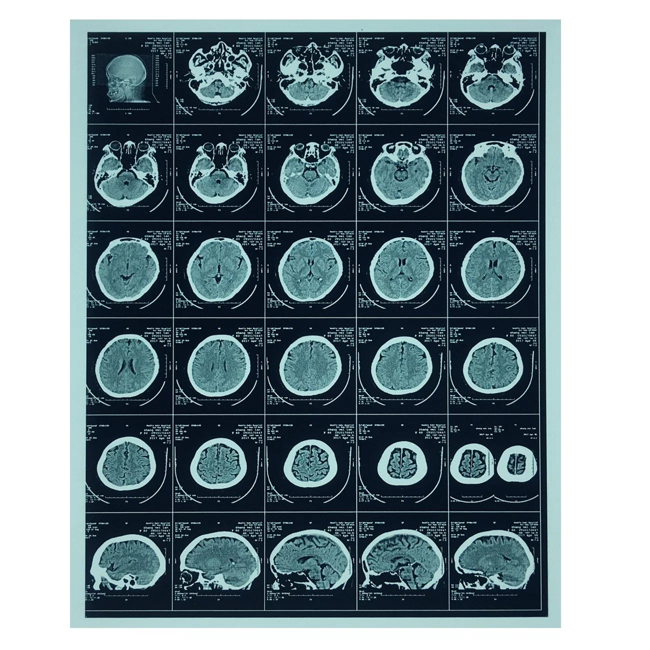 Thermique médicaux de diagnostic X-ray Support pour imprimante agfa Drystar 5301