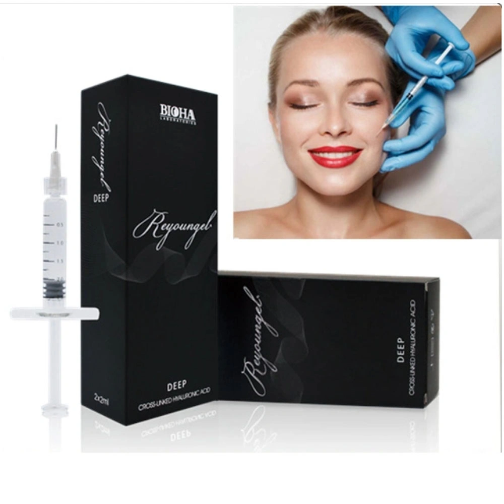 Reyoungel Hyaluronic Acid Injectable 1ml 2ml Dermal Filler for Lip Cheek Chin Injection