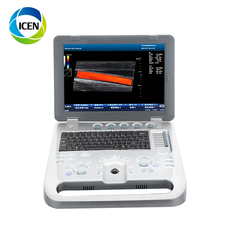 IN-A8 Portable 3D 4D Color Doppler Pregnancy  Probe Ultrasound  Scanner