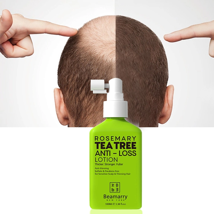 OEM/ODM cosméticos de cuidado del cabello productos para el cabello de Árbol de Té de Romero Anti-Loss la loción para el crecimiento del cabello productos