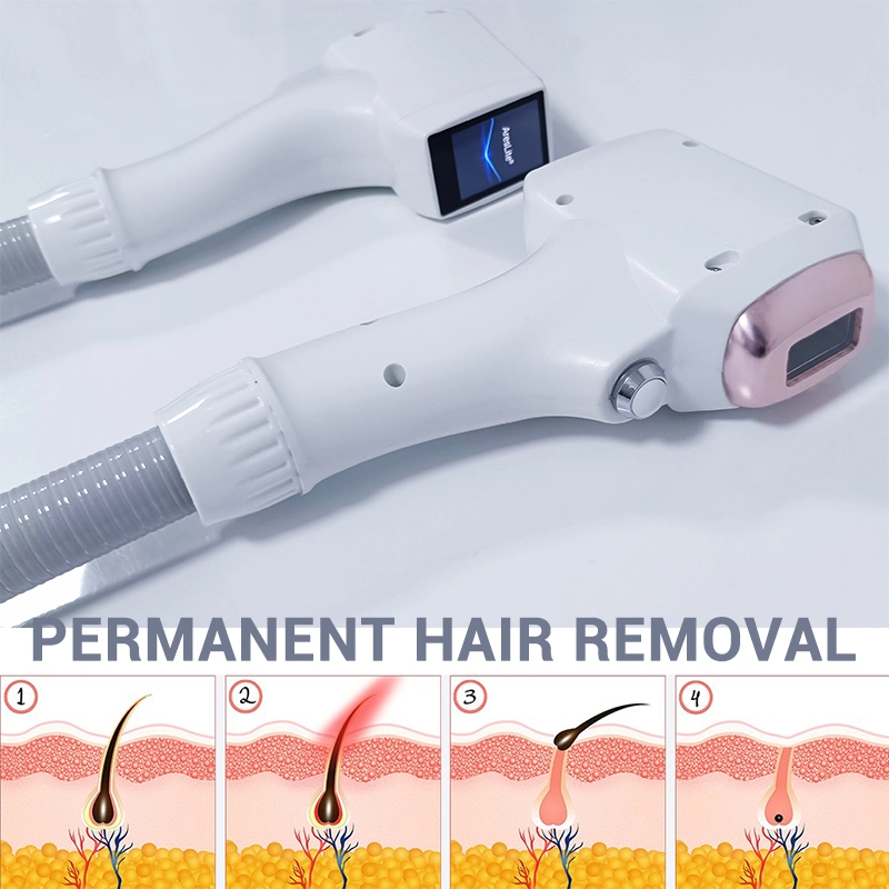 Winkonlaser 808nm Diode Laser Hair Removal Medical Machine