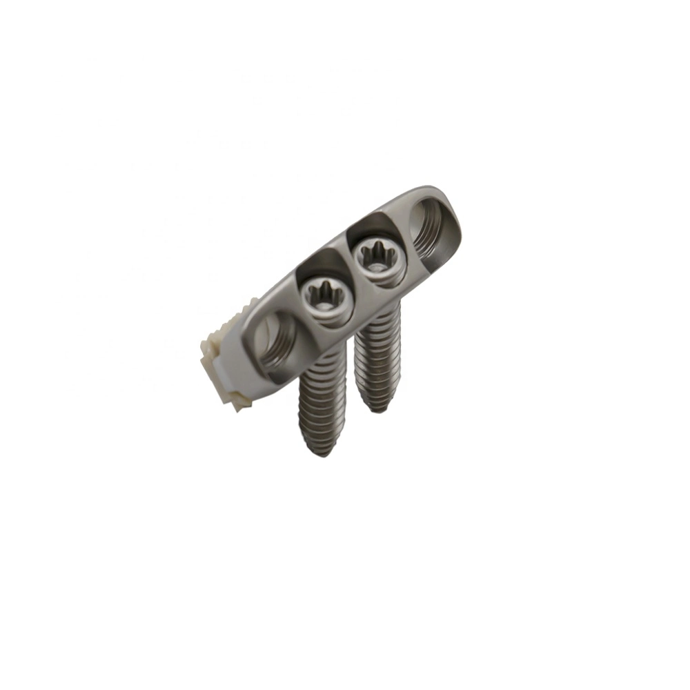 Titanium Spinal Implant Fixation Internal Surgical Spine Thread Pedicle Screw Multi Axial