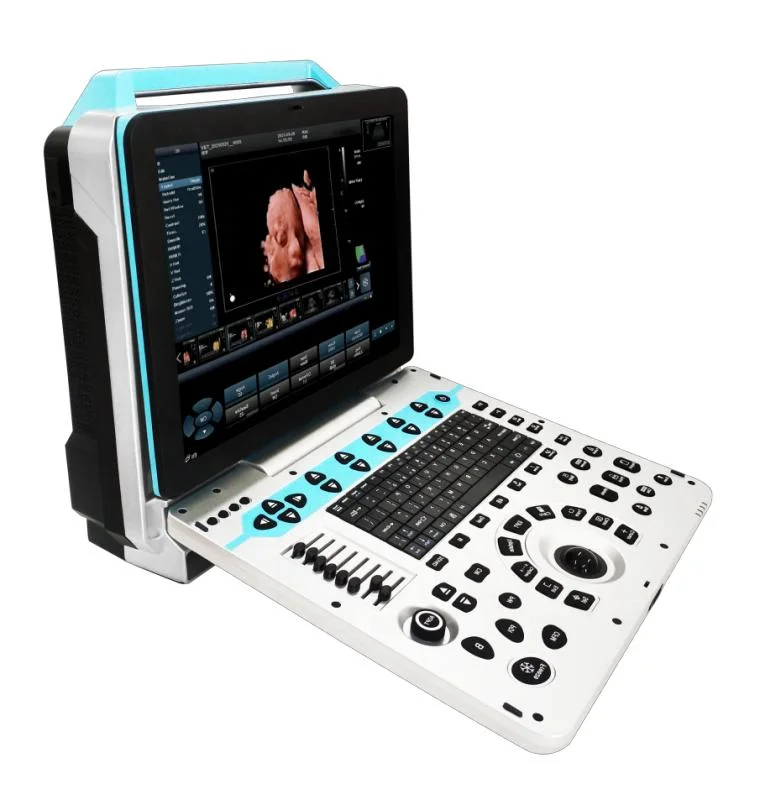 Medical Portable Echo Sonar Real Skin 3D 4D 5D Ultrasound Color Doppler Scanner Machine for Ob/Gyn Hew-P50