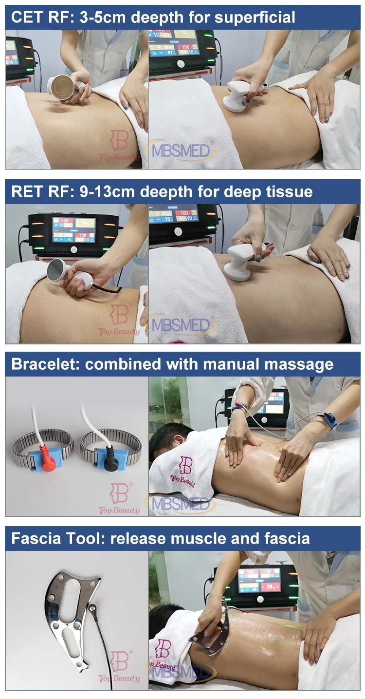 Nueva llegada Smart Tecar Terapia Fisioterapia 448kHz dispositivo de eliminación de celulitis Equipo delgado de Diatermia de Terapia Física Tecar