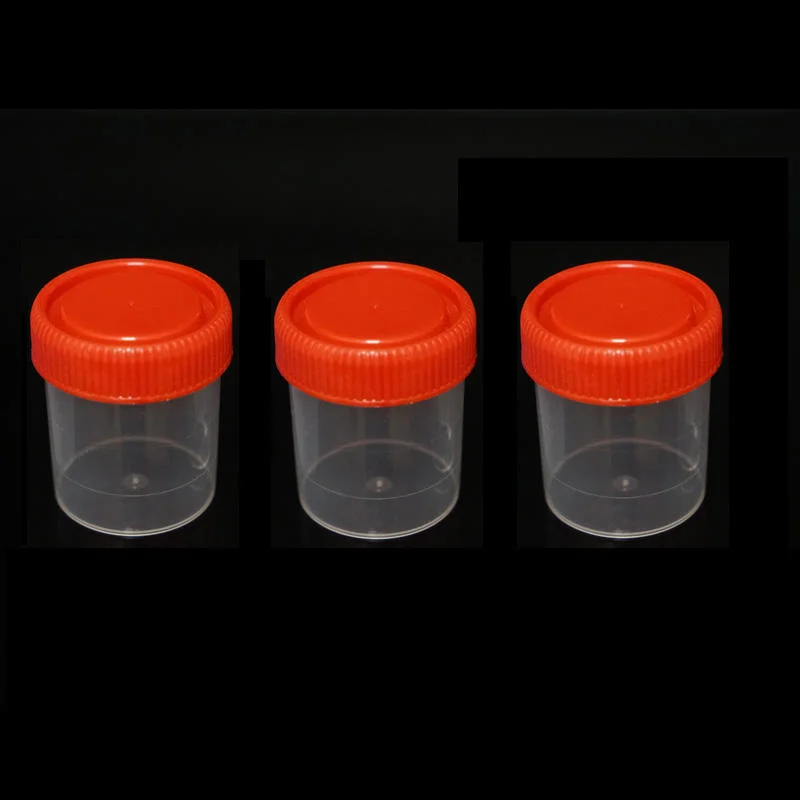 Siny High quality/High cost performance  30ml 40ml Medical Sterile Plastic Specimen Disposable Fecal Container Bottle Stool Sample Container