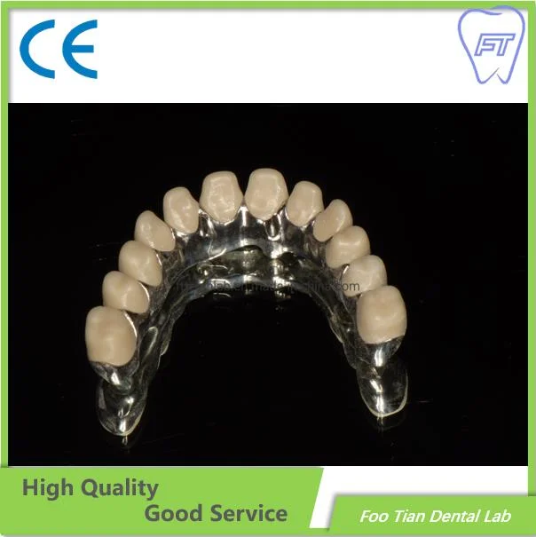 Hybrid Implant Denture Supplies Dental Custom Titanium Abutments Used for Implant Cases