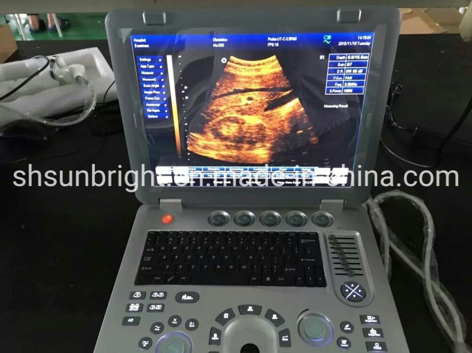 China Portable Msk Ultrasound 3D/4D Medical Full Digital Ultrasound Diagnostic