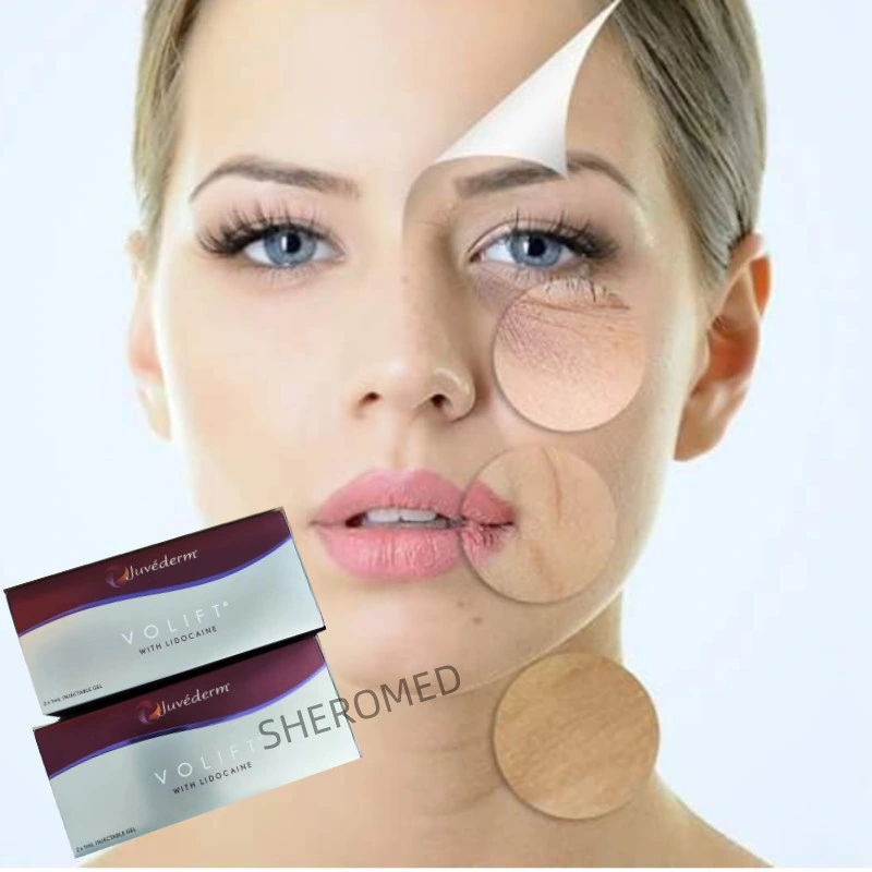 Mejor Precio Belleza piel Juvederms ácido Hialurónico relleno Dermal 2*1ml