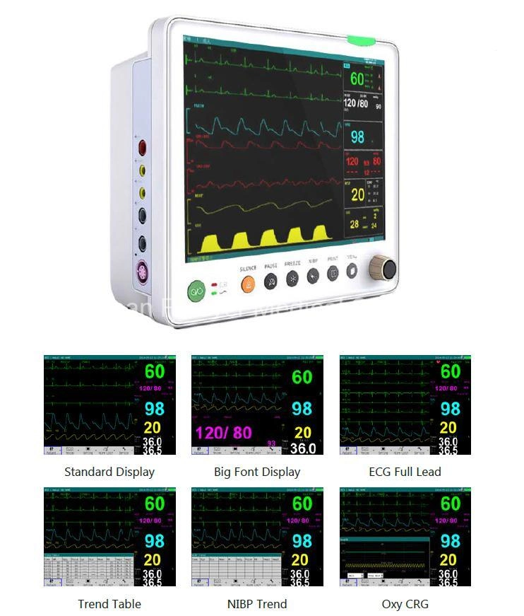 China Supply CE Approved 12.1 Inches Multi-Parameter Patient Monitor