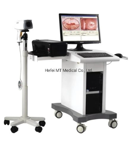 Mt Medical Digital Colposcope Imaging System Vagina Examination Colposcope for Gynecology