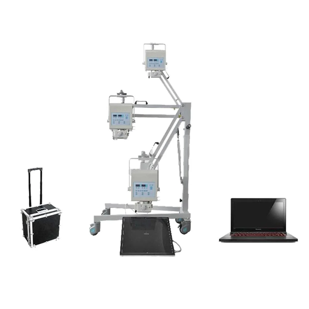 5kw/8kw Portable Digital X-ray Machine Wireless 14*17 Fpd