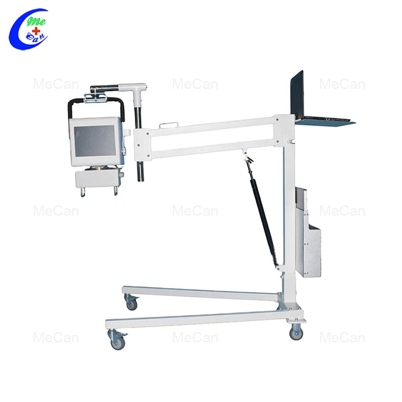 300 Ma 32kw Other Radiology Equipment Medical X Ray Portable X-ray Machine with Cheap Price