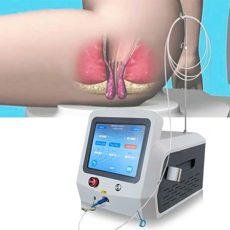 Diode Laser Surgery 980nm 1470nm Hemorrhoid Laser Fiber Proctology Surgery Anal Fistula Radial Fiber